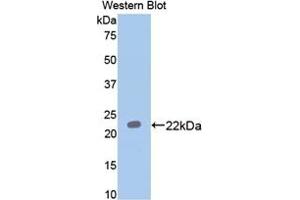 Detection of Recombinant PON1, Rat using Polyclonal Antibody to Paraoxonase 1 (PON1) (PON1 抗体  (AA 2-186))