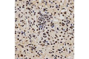 Immunohistochemistry (IHC) image for anti-Proline-, Glutamic Acid- and Leucine-Rich Protein 1 (PELP1) (AA 1021-1180) antibody (ABIN3023502)