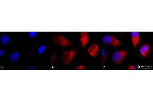 Immunocytochemistry/Immunofluorescence analysis using Rabbit Anti-TNF-R1 Polyclonal Antibody . (TNFRSF1A 抗体  (AA 20-43) (APC))