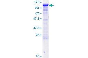 DLG3 Protein (AA 1-817) (GST tag)