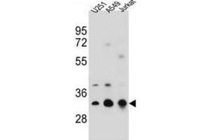 Western Blotting (WB) image for anti-Tropomyosin 4 (TPM4) antibody (ABIN2996933) (Tropomyosin 4 抗体)