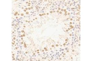Immunohistochemistry analysis of paraffin-embedded rat testis using,PSIP1 (ABIN7074997) at dilution of 1: 3000 (PSIP1 抗体)