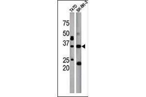 The anti-ICMT Pab (ABIN389122 and ABIN2839304) is used in Western blot to detect ICMT in T47D (left) and SK-BR-3 (right) tissue lysate