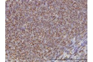 Image no. 1 for anti-Adducin 1 (Alpha) (ADD1) (AA 1-663) antibody (ABIN598527) (alpha Adducin 抗体  (AA 1-663))