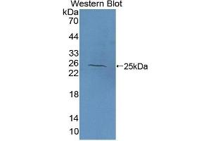 Detection of Recombinant NAGa, Human using Polyclonal Antibody to N-Acetylgalactosaminidase Alpha (NAGa) (NAGA 抗体  (AA 18-217))