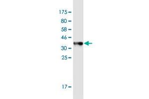 Western Blot detection against Immunogen (35. (Mammaglobin A 抗体  (AA 1-93))