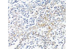 Immunohistochemistry of paraffin-embedded Human tonsil using HSD17B10 Polyclonal Antibody at dilution of 1:100 (40x lens). (HSD17B10 抗体)