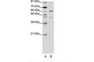 Image no. 1 for anti-Zinc Finger Protein 496 (ZNF496) (N-Term) antibody (ABIN202790) (ZNF496 抗体  (N-Term))