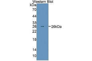 Detection of Recombinant ABCD2, Mouse using Polyclonal Antibody to ATP Binding Cassette Transporter D2 (ABCD2) (CCL17 抗体  (AA 501-695))