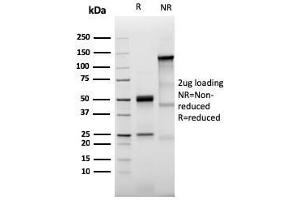 SDS-PAGE Analysis Purified Prolactin Receptor Recombinant Rabbit Monoclonal (PRLR3785R). (Recombinant Prolactin Receptor 抗体)