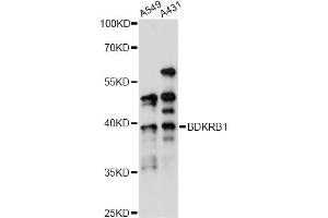 Western blot analysis of extracts of various cell lines, using BDKRB1 antibody (ABIN6290094) at 1:1000 dilution. (BDKRB1 抗体)