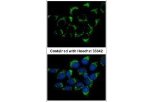 ICC/IF Image Immunofluorescence analysis of methanol-fixed A431, using CMG1, antibody at 1:500 dilution. (IFT74 抗体  (C-Term))