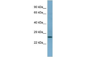WB Suggested Anti-APIP  Antibody Titration: 0. (APIP 抗体  (Middle Region))