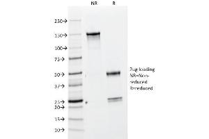 SDS-PAGE Analysis Purified BrdU Mouse Monoclonal Antibody (BRD469). (BrdU 抗体)
