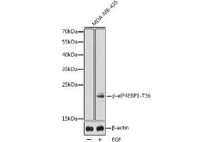 Western blot analysis of extracts from MDA-MB-435 cells, using Phospho-eIF4EBP1-T36 antibody (ABIN3020195, ABIN3020196, ABIN3020197 and ABIN1681563). (eIF4EBP1 抗体  (pThr36))