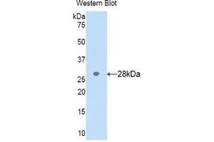 Western Blotting (WB) image for anti-Cytochrome P450, Family 2, Subfamily D, Polypeptide 6 (CYP2D6) (AA 236-472) antibody (ABIN7437350)