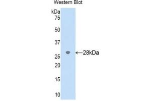 Detection of Recombinant CYP2D6, Human using Polyclonal Antibody to Cytochrome P450 2D6 (CYP2D6) (CYP2D6 抗体  (AA 236-472))