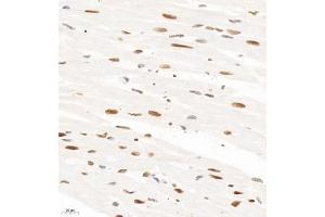 Immunohistochemistry analysis of paraffin-embedded rat heart using HNRNPM (ABIN7074247) at dilution of 1: 4000 (HnRNP M1-M4 抗体)
