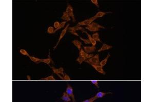 Immunofluorescence analysis of HeLa cells using UBE2J1 Polyclonal Antibody at dilution of 1:100. (UBE2J1 抗体)