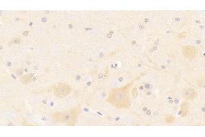 Detection of NOS1 in Mouse Cerebellum Tissue using Polyclonal Antibody to Nitric Oxide Synthase 1, Neuronal (NOS1) (NOS1 抗体  (AA 691-826))