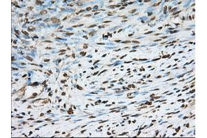 Immunohistochemical staining of paraffin-embedded Human Kidney tissue using anti-PDE4A mouse monoclonal antibody. (PDE4A 抗体)
