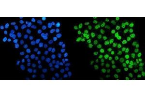IF analysis of HDAC5 using anti-HDAC5 antibody (ABIN7599922). (HDAC5 抗体  (AA 13-1107))