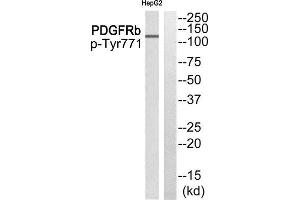 Western Blotting (WB) image for anti-Epidermal Growth Factor Receptor Pathway Substrate 15 (EPS15) (pTyr849) antibody (ABIN1847772) (EPS15 抗体  (pTyr849))