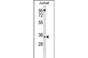 Western blot analysis in Jurkat cell line lysates (35ug/lane). (UBXN8 抗体  (N-Term))