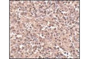 Immunohistochemistry: ATG5 antibody staining of Rat Spleen tissue lysate at 2 μg/ml