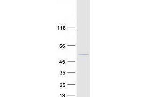 Western Blotting (WB) image for Tubulin, gamma 2 (TUBG2) protein (Myc-DYKDDDDK Tag) (ABIN2734587)