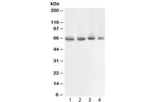 Western blot testing of 1) rat muscle, 2) human COLO320, 3) human 22RV1 and 4) human PANC lysate with ABCB10 antibody at 0.