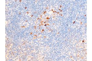 ABIN6267224 at 1/100 staining mouse spleen tissue sections by IHC-P. (CHEK1 抗体  (pSer317))