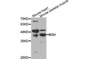 Western blot analysis of extracts of various cell lines, using BGN antibody (ABIN5973392) at 1/1000 dilution. (Biglycan 抗体)