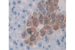 Used in DAB staining on fromalin fixed paraffin- embedded Kidney tissue (APBA3 抗体  (AA 261-506))