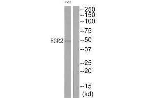 Western blot analysis of extracts from K562 cells, using EGR2 antibody. (EGR2 抗体  (C-Term))