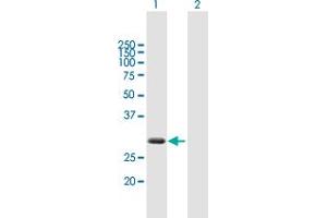Western Blot analysis of ZBED2 expression in transfected 293T cell line by ZBED2 MaxPab polyclonal antibody. (ZBED2 抗体  (AA 1-218))