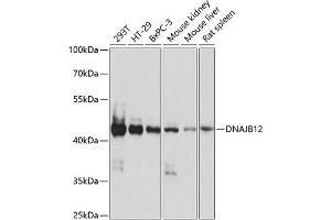 Western blot analysis of extracts of various cell lines, using DN antibody (ABIN7266820) at 1:1000 dilution. (DNAJB12 抗体  (AA 250-409))