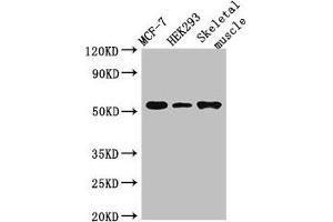 Western Blot Positive WB detected in: MCF-7 whole cell lysate, HEK293 whole cell lysate, Mouse skeletal muscle tissue All lanes: RMND1 antibody at 3 μg/mL Secondary Goat polyclonal to rabbit IgG at 1/50000 dilution Predicted band size: 52, 28, 24 kDa Observed band size: 52 kDa (RMND1 抗体  (AA 35-160))