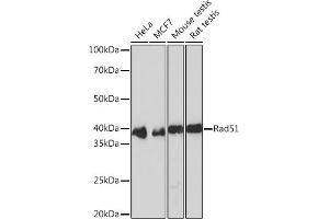 Western blot analysis of extracts of various cell lines, using Rad51 Rabbit mAb (ABIN3016792, ABIN3016793, ABIN1682438 and ABIN1682439) at 1:1000 dilution. (RAD51 抗体)