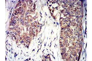 Immunohistochemistry (IHC) image for anti-Sema Domain, Immunoglobulin Domain (Ig), Transmembrane Domain (TM) and Short Cytoplasmic Domain, (Semaphorin) 4D (SEMA4D) (AA 590-734) antibody (ABIN5611304)