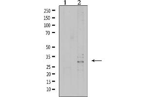 Western blot analysis of extracts from 293, using VTCN1 Antibody. (VTCN1 抗体  (Internal Region))