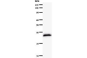 Western Blotting (WB) image for anti-Golgin B1 (GOLGB1) antibody (ABIN931100)