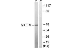 Western Blotting (WB) image for anti-Mitochondrial Transcription Termination Factor (MTERF) (Internal Region) antibody (ABIN1852304) (MTERF 抗体  (Internal Region))