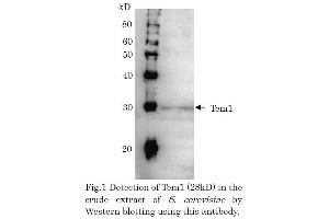 Western Blotting (WB) image for anti-CD248 Molecule, Endosialin (CD248) (full length) antibody (ABIN2452152) (CD248 抗体  (full length))