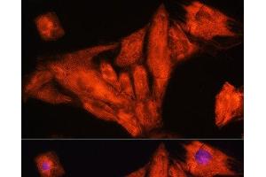 Immunofluorescence analysis of H9C2 cells using RIG-I / DDX58 Polyclonal Antibody at dilution of 1:100. (DDX58 抗体)