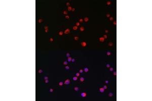 Immunofluorescence analysis of Neuro-2a cells using ALK antibody  at dilution of 1:200. (ALK 抗体  (AA 19-300))