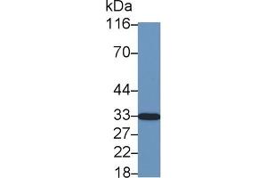 Detection of CDKN1B in Cavia Cerebrum lysate using Polyclonal Antibody to Cyclin Dependent Kinase Inhibitor 1B (CDKN1B) (CDKN1B 抗体  (AA 2-197))