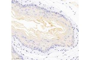 Immunohistochemistry analysis of paraffin-embedded mouse esophagus using,DSP (ABIN7073719) at dilution of 1: 1000 (Desmoplakin 抗体)