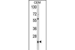 Western blot analysis of PRDX1 Antibody (Center) (ABIN389467 and ABIN2839531) in CEM cell line lysates (35 μg/lane). (Peroxiredoxin 1 抗体  (AA 88-116))