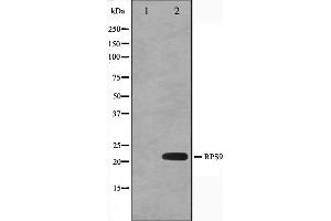 Western blot analysis on HeLa cell lysate using RPS9 Antibody,The lane on the left is treated with the antigen-specific peptide. (RPS9 抗体  (Internal Region))